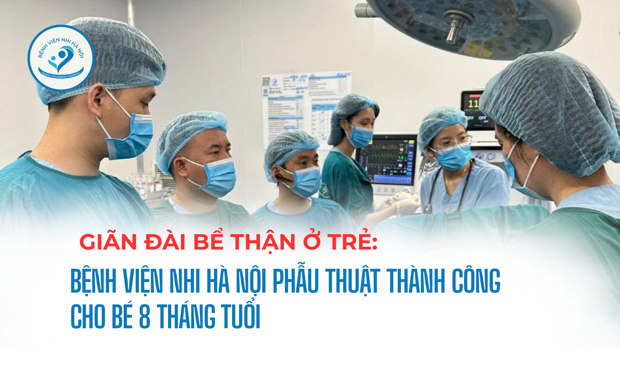 GIÃN ĐÀI BỂ THẬN Ở TRẺ: BỆNH VIỆN NHI HÀ NỘI PHẪU THUẬT THÀNH CÔNG CHO BÉ 8 THÁNG TUỔI BẰNG PHẪU THUẬT NỘI SOI MỘT LỖ QUA RỐN