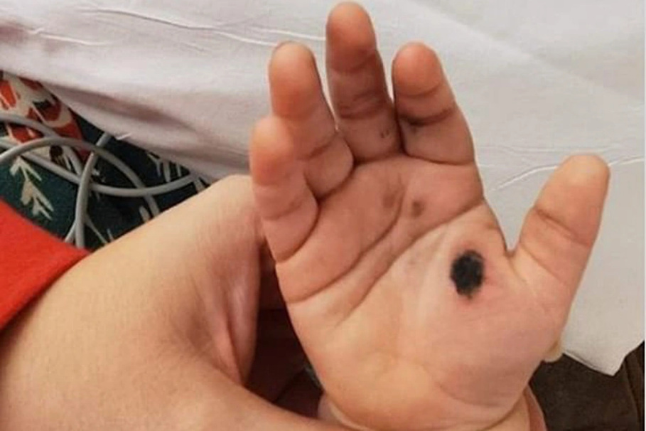 5 ĐIỀU CHA MẸ CẦN BIẾT ĐỂ PHÒNG NGỪA VÀ XỬ TRÍ ĐIỆN GIẬT Ở TRẺ EM