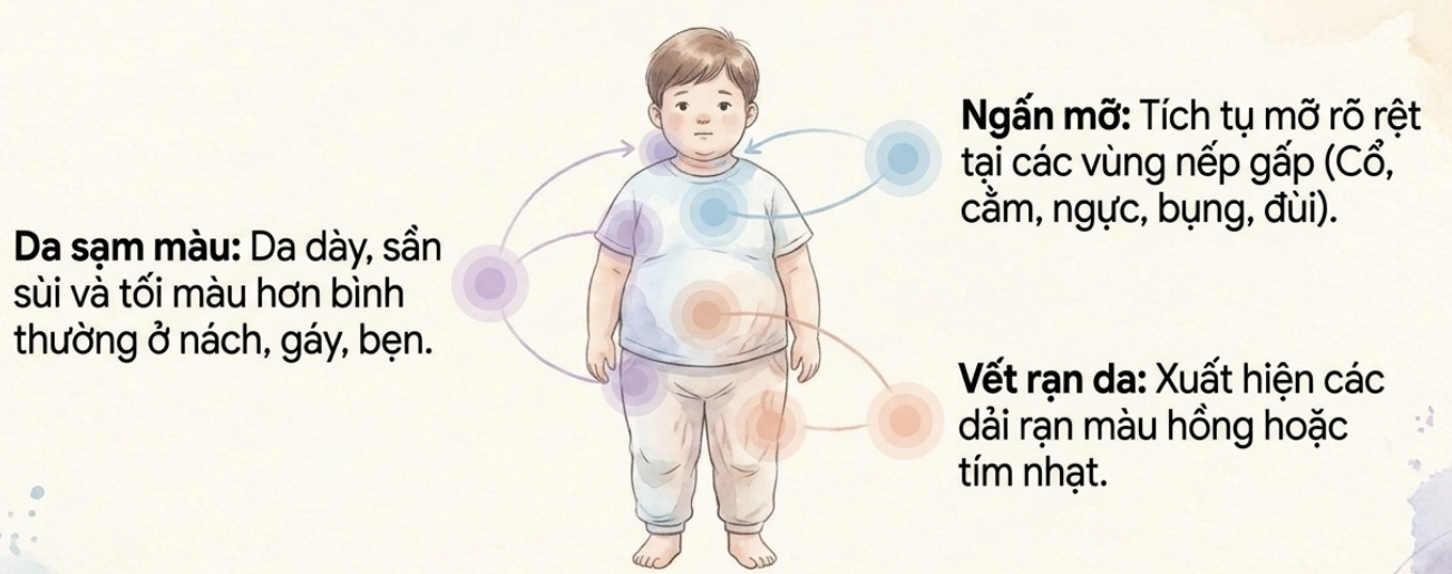 4 DẤU HIỆU NHẬN BIẾT SỚM THỪA CÂN, BÉO PHÌ Ở TRẺ EM CHA MẸ CẦN BIẾT
