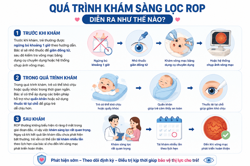 BỆNH VÕNG MẠC TRẺ SINH NON (ROP): 4 ĐIỀU CẦN BIẾT